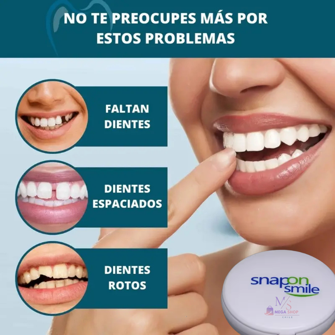 SÚPER SONRISA 2x1 — Carillas SnapOn Smile