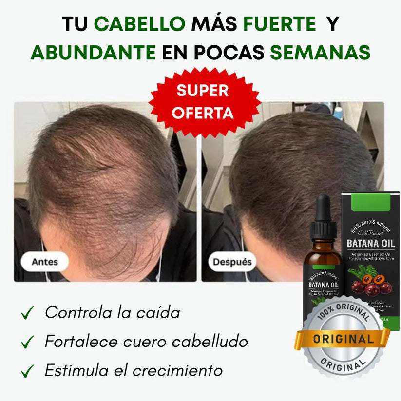 Aceite de Batana 100% Natural – 2x1