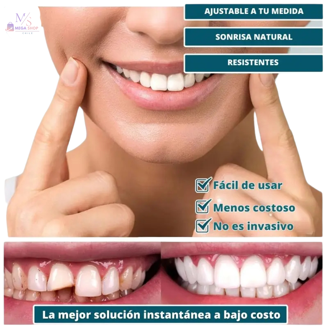 SÚPER SONRISA 2x1 — Carillas SnapOn Smile