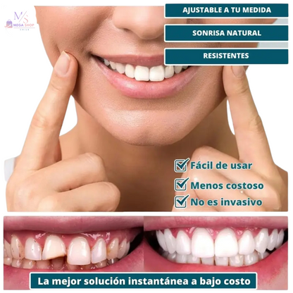 SÚPER SONRISA 2x1 — Carillas SnapOn Smile